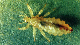 Head lice (pediculosis)