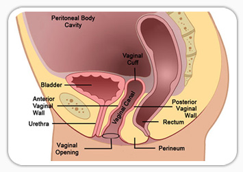 Hysterectomy Sex After 31