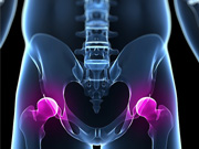 Hip Replacement Doctor in Kolkata