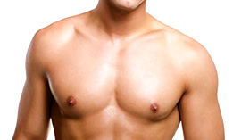 Gynecomastia