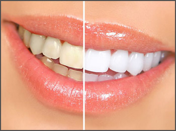 Cosmetic Dentistry