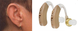 Behind - The - Ear (BTE)