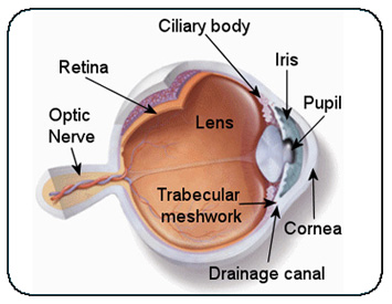 glaucoma