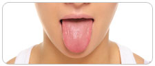 Tongue Cancer