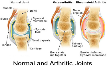 pelvic fracture surgery india