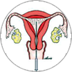 Intra Uterine Insemination (IUI)