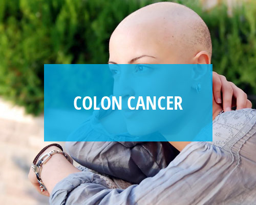 Colon Cancer