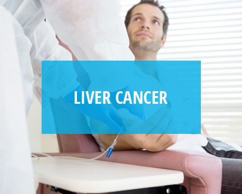 Liver Cancer