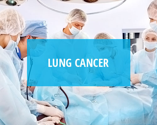 Lung Cancer