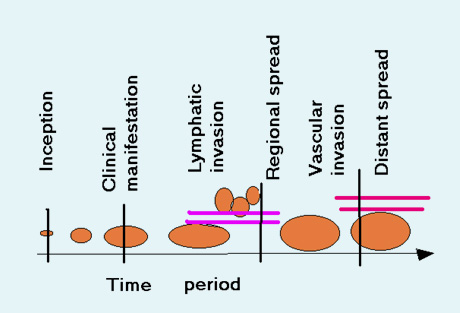 Rationale of excising a Cancerous Growth
