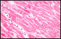 Histopathology