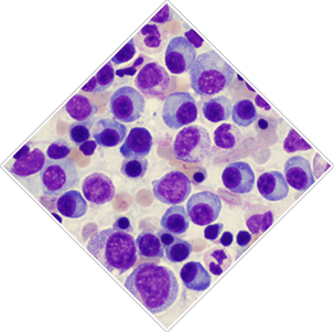 Myeloma