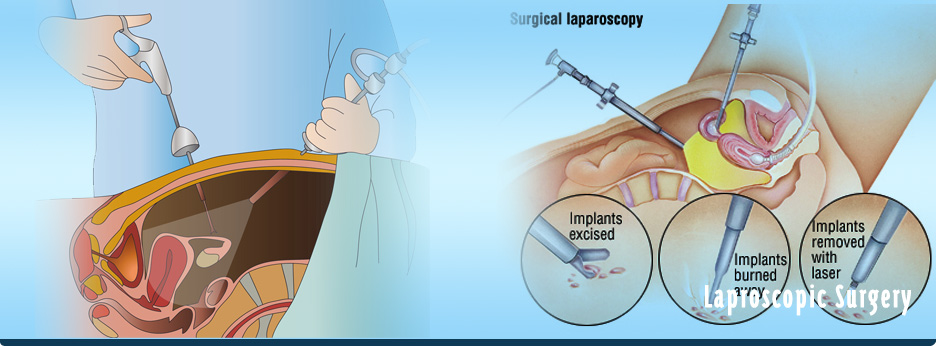 Arthroscopy