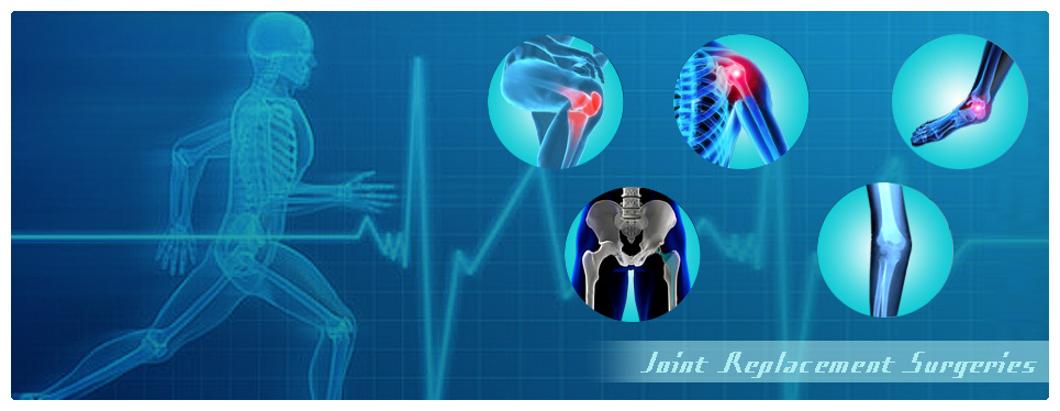 Joint Replacement Surgeries