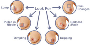 Dr. Tanmoy Mukhopadhyay Radiation Therapy