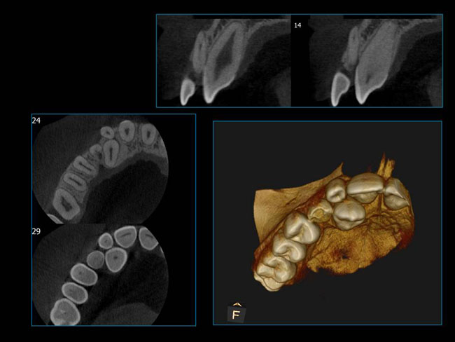 Oromax Imaging radiology & oral