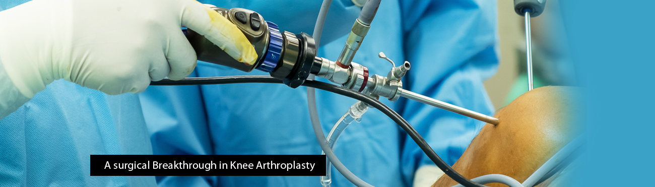 Total Knee Replacement in Kolkata