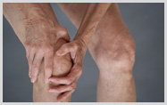 OSTEOARTHRITIS