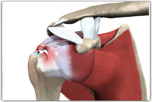 Rotator Cuff Disease