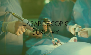 Laparoscopic Surgery