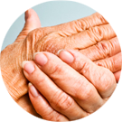 Arthritis