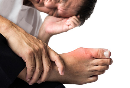 Gout
