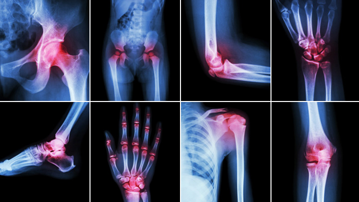 Best Rheumatologist Kolkata