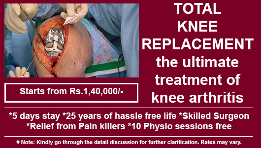 Total Knee Replacement