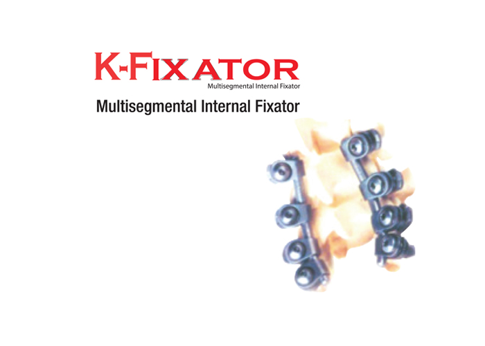 K FIXATOR