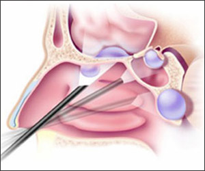 ENDOSCOPIC SKULL BASE SURGERY