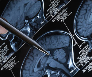 ENDOSCOPIC SKULL BASE SURGERY