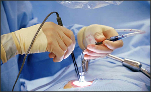 Minimally Invasive Spine Surgery