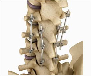 Minimally Invasive Spine Surgery