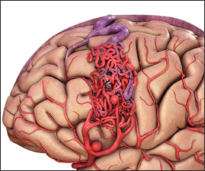 Pediatric Neurosurgery