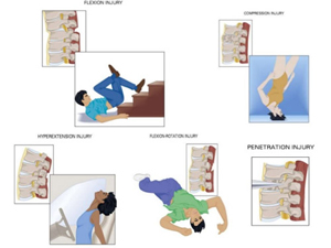 Spinal Trauma