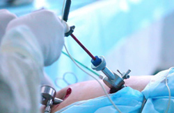 ADVANCED LAPAROSCOPIC SURGERY