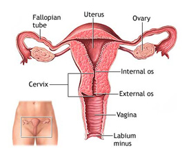 ovarian cysts