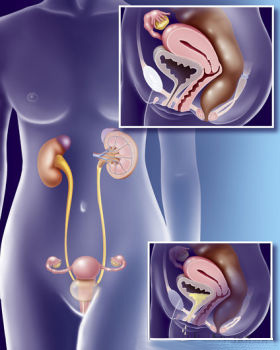 urinary